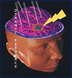 illustration representing functional electrical stimulation.
