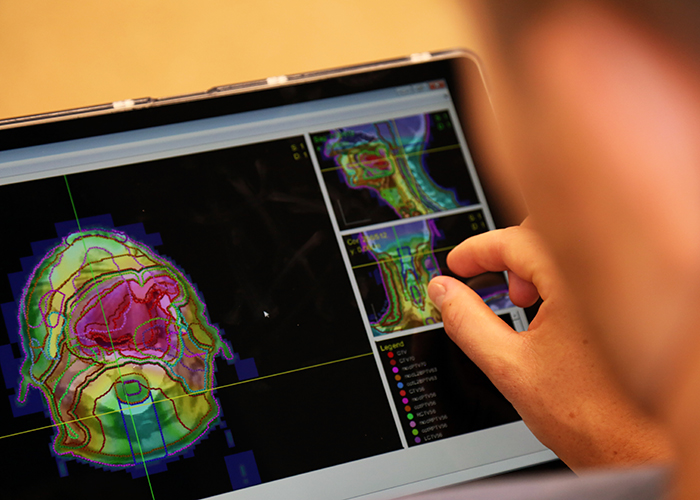 Aaron Babier (MIE PhD candidate) is using AI technology to automate radiation therapy planning. (Credit: Brian Tran)