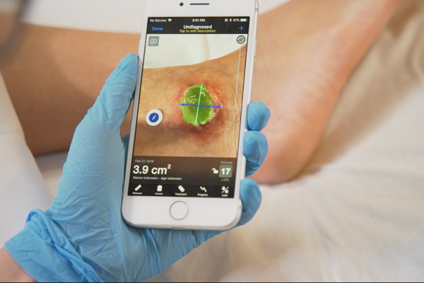 Swift Skin and Wound, a wound care management software created by Swift Medical, helps health care providers quickly and accurately track the progression of chronic wounds and the effectiveness of their treatment. (Courtesy: Swift Medical)