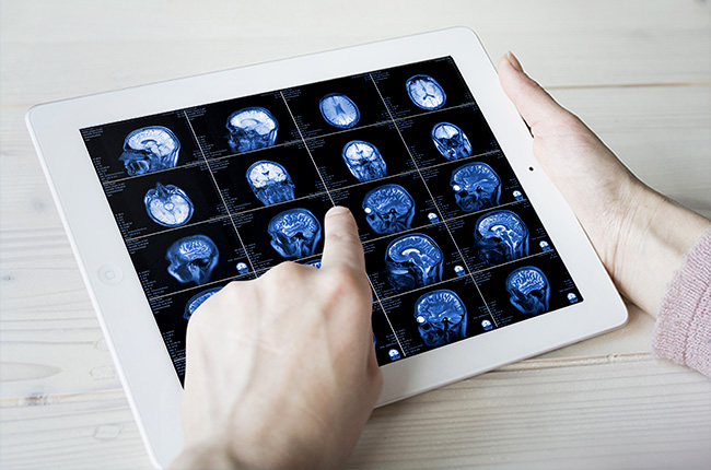 Gamma Knife radiosurgery, performed mainly on the brain, uses medical imaging to create a treatment plan, which can be optimized by a quantum-inspired technology called the Digital Annealer. (Photo by Nikita Karchevskyi via Envato)