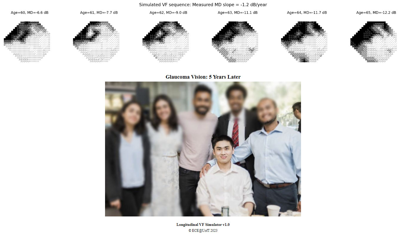 Graphical representations of eye appear over a photo simulating the effects of the disease.